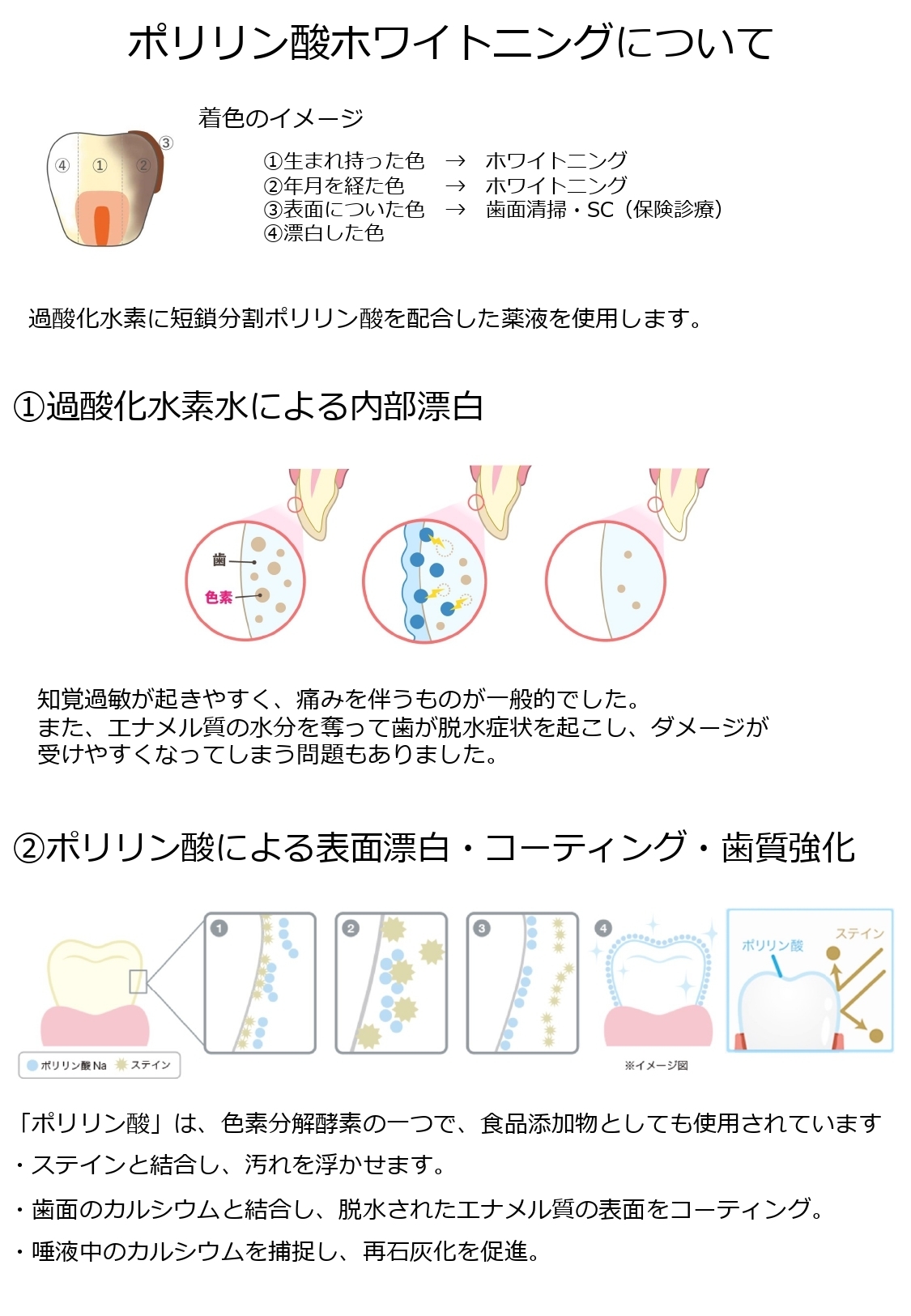 浜松市中央区・自動車学校前駅のホワイトニング