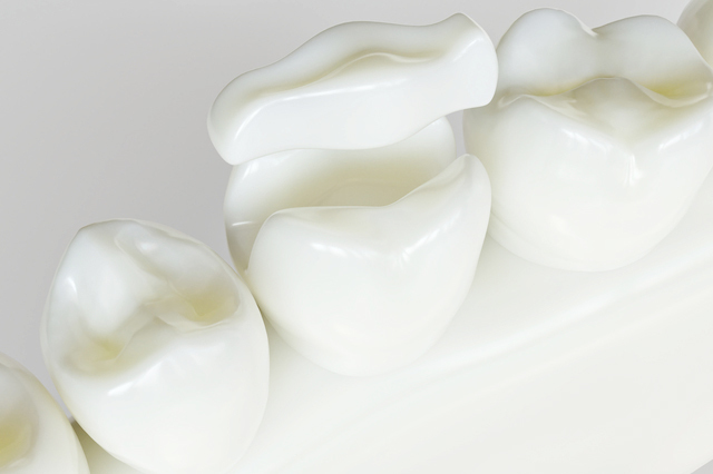 浜松市中央区・自動車学校前駅の歯ぎしり治療（ナイトガード）