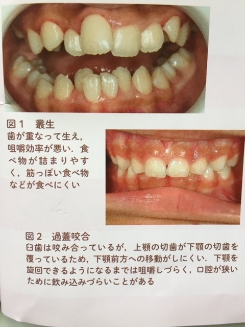 小児歯科 ニワ歯科医院 浜松市東区 自動車学校前駅